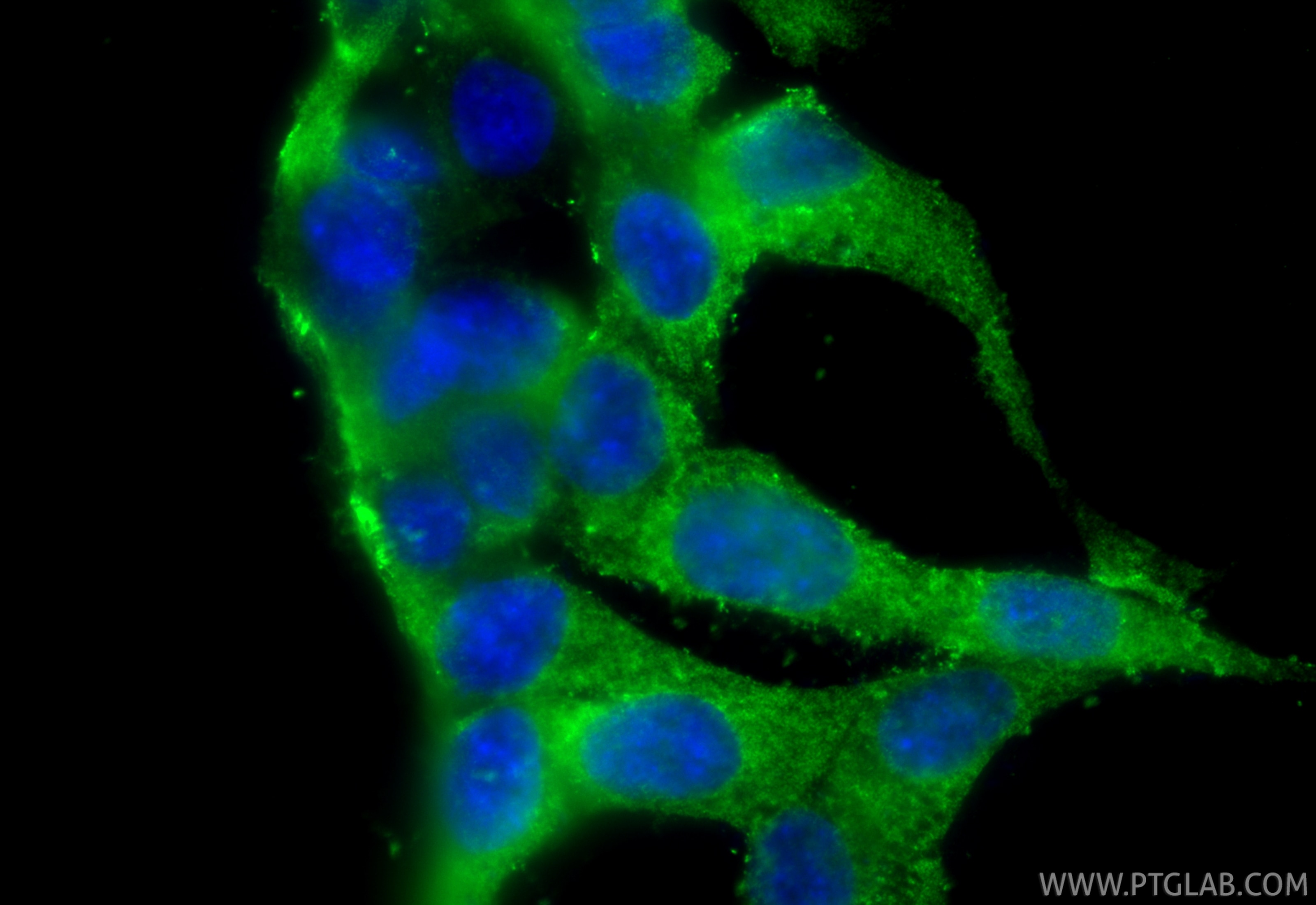 Immunofluorescence (IF) / fluorescent staining of HCT 116 cells using RNF25 Polyclonal antibody (24536-1-AP)