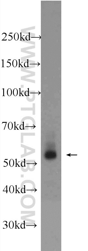 Western Blot (WB) analysis of HeLa cells using RNF25 Polyclonal antibody (24536-1-AP)