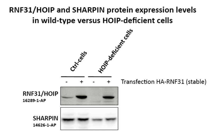 Western Blot (WB) analysis of Transfected cell
cell using HOIP Polyclonal antibody (16289-1-AP)