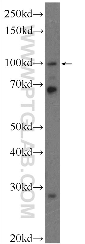 Western Blot (WB) analysis of HeLa cells using HOIP Polyclonal antibody (16289-1-AP)