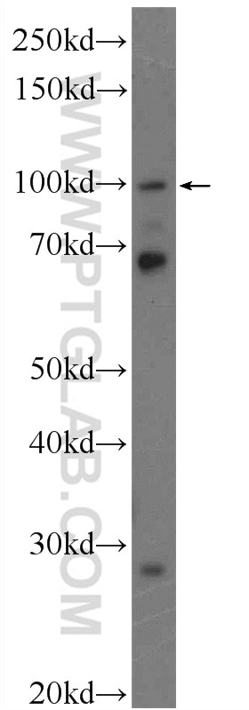 WB analysis of HeLa using 16289-1-AP