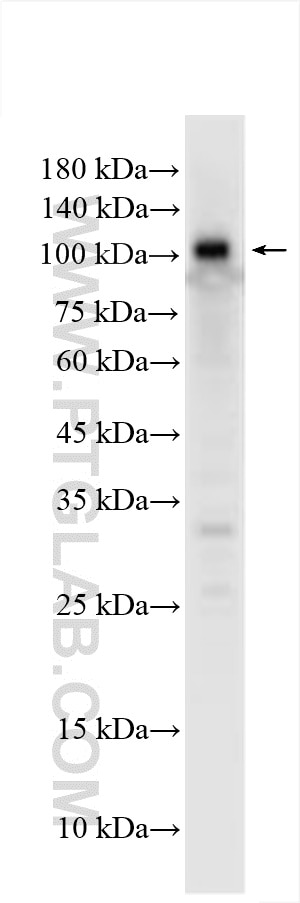 Western Blot (WB) analysis of MCF-7 cells using RNF31 / HOIP Polyclonal antibody (30797-1-AP)