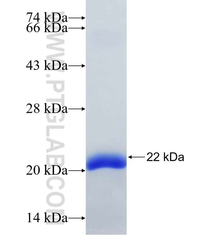 RNF31 fusion protein Ag34426 SDS-PAGE RNF31 fusion protein Ag34426 SDS-PAGE