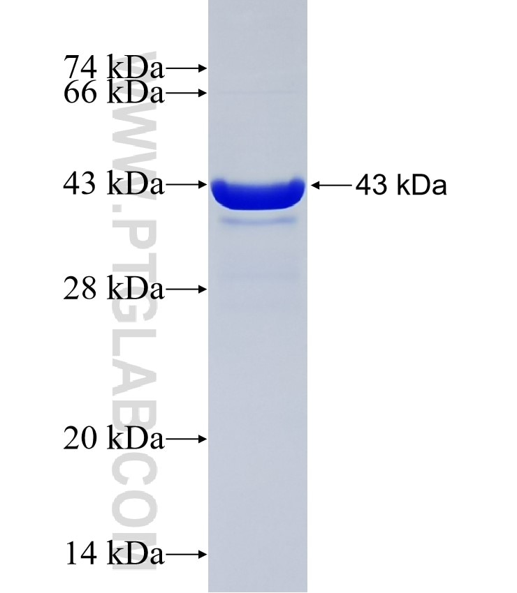 RNF31 fusion protein Ag34505 SDS-PAGE