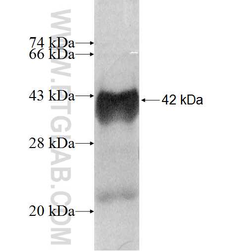 RNF31 fusion protein Ag9440 SDS-PAGE