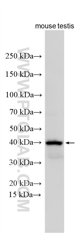 Western Blot (WB) analysis of various lysates using RNF32 Polyclonal antibody (17471-1-AP)