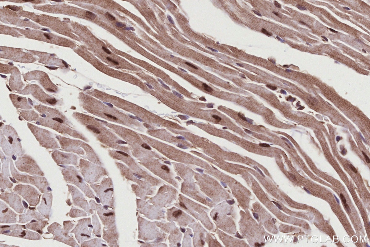 Immunohistochemistry (IHC) staining of mouse heart tissue using RNF34 Polyclonal antibody (10629-1-AP)
