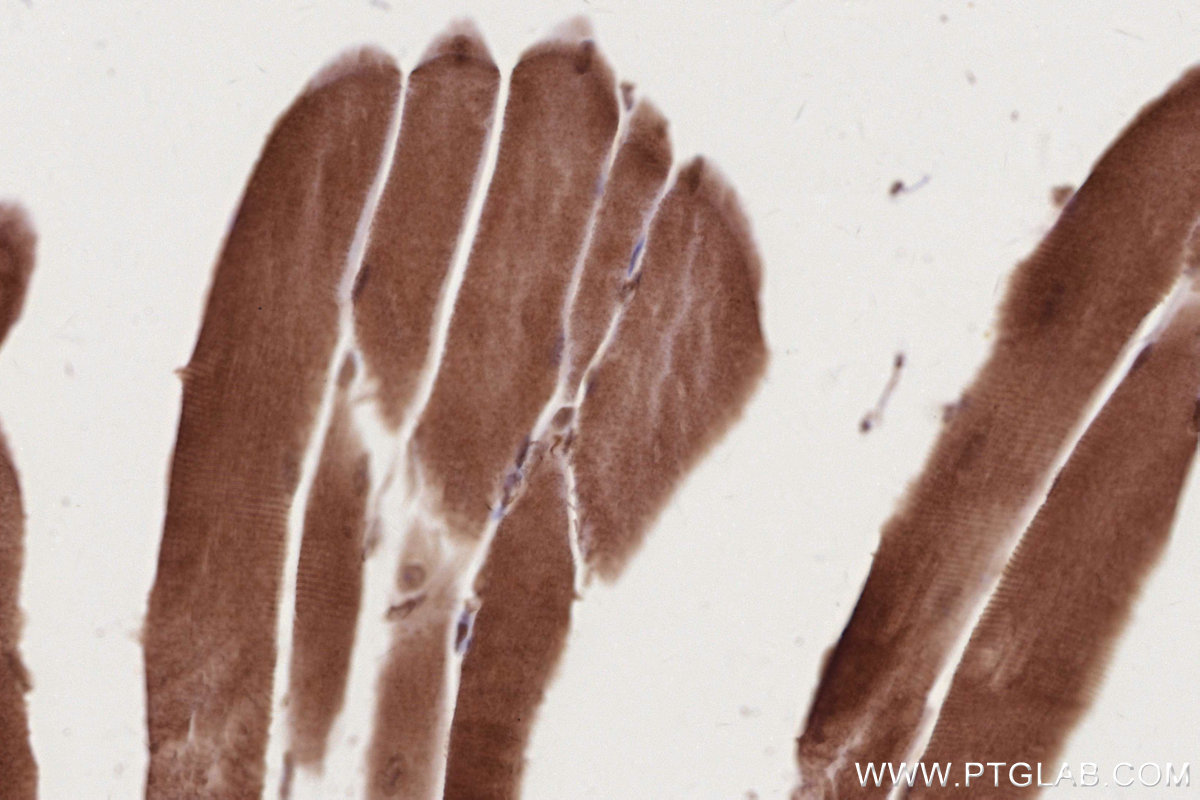 Immunohistochemistry (IHC) staining of mouse skeletal muscle tissue using RNF34 Polyclonal antibody (10629-1-AP)