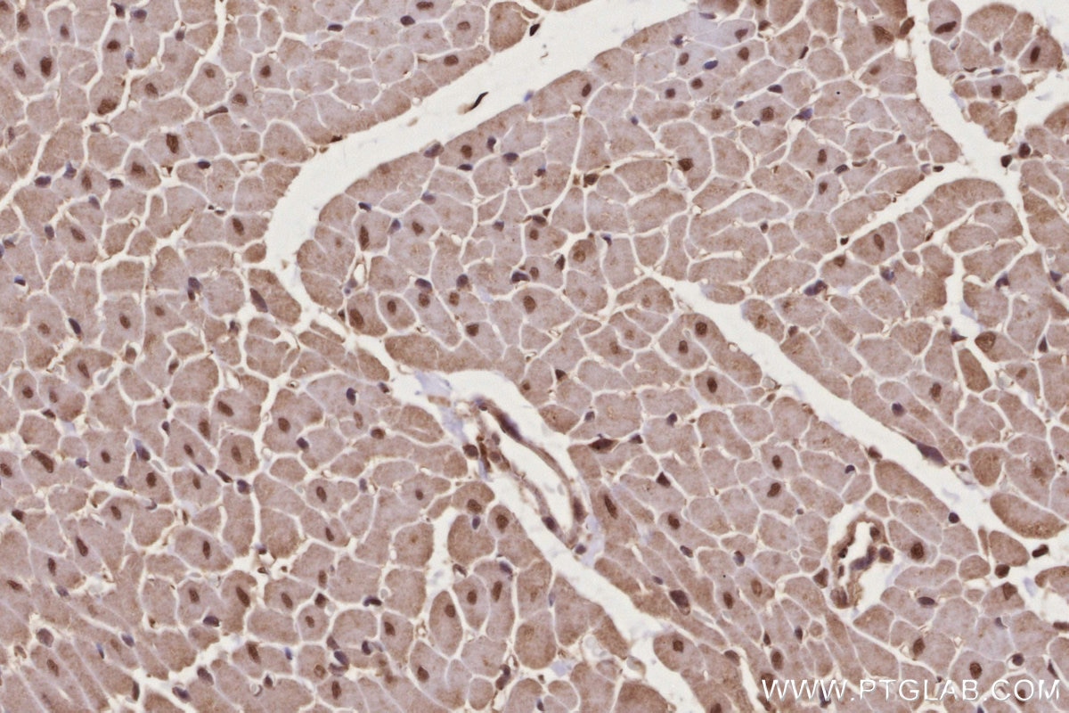 Immunohistochemistry (IHC) staining of rat heart tissue using RNF34 Polyclonal antibody (10629-1-AP)