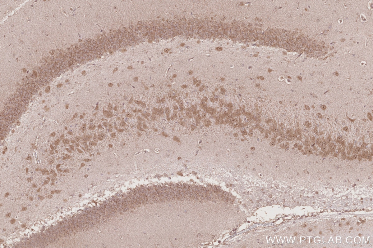 Immunohistochemistry (IHC) staining of rat brain tissue using RNF34 Polyclonal antibody (10629-1-AP)
