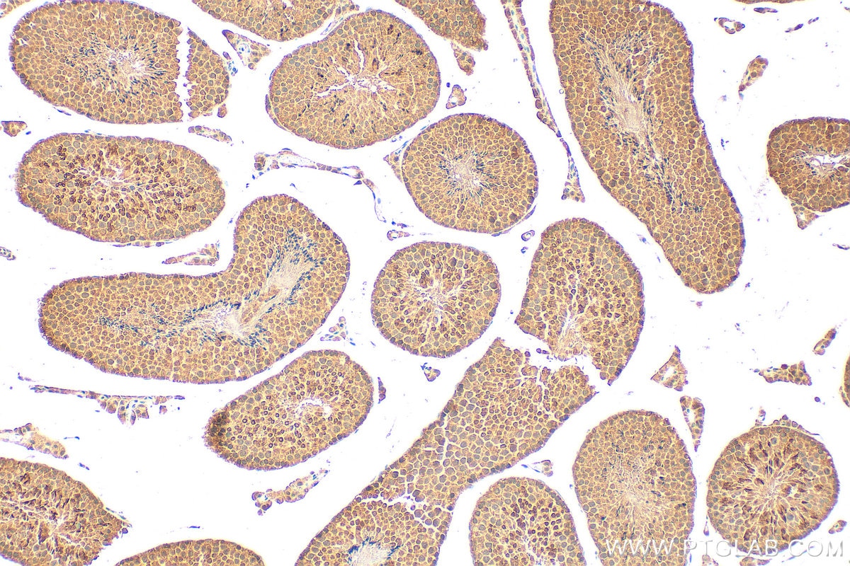 Immunohistochemistry (IHC) staining of mouse testis tissue using RNF4 Polyclonal antibody (17810-1-AP)