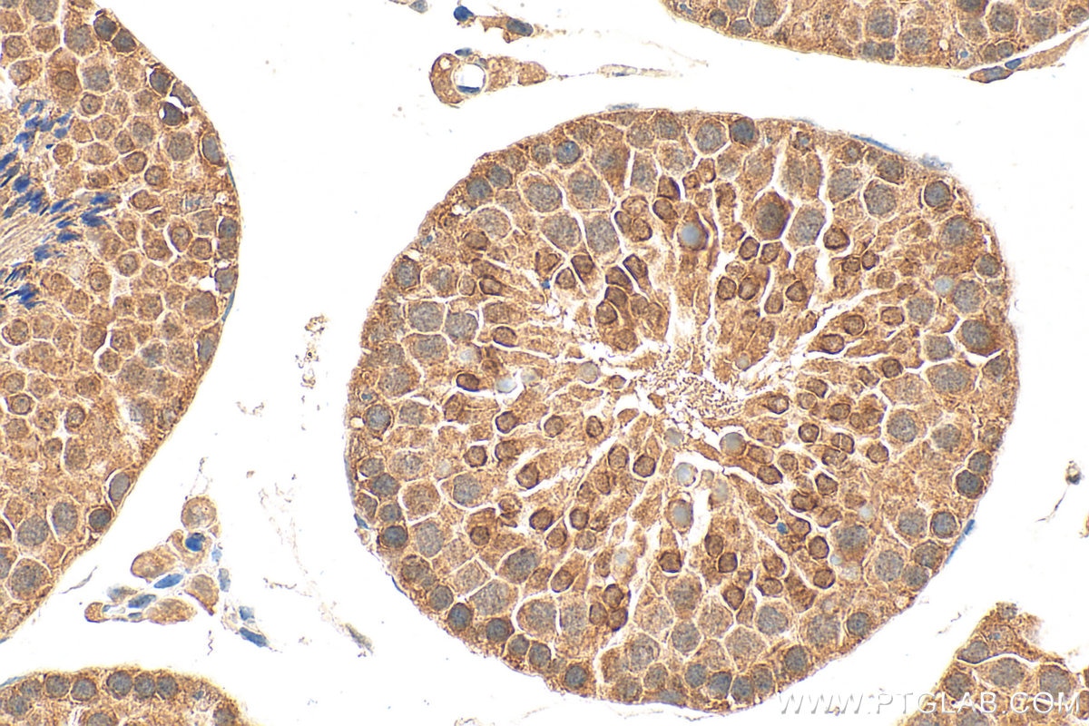 Immunohistochemistry (IHC) staining of mouse testis tissue using RNF4 Polyclonal antibody (17810-1-AP)