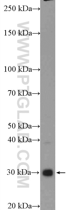 Western Blot (WB) analysis of PC-3 cells using RNF4 Polyclonal antibody (17810-1-AP)