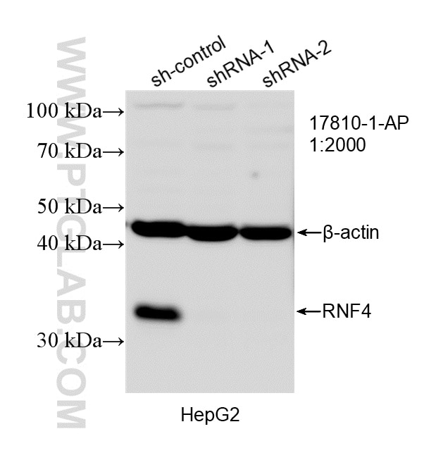 Western Blot (WB) analysis of HepG2 cells using RNF4 Polyclonal antibody (17810-1-AP)