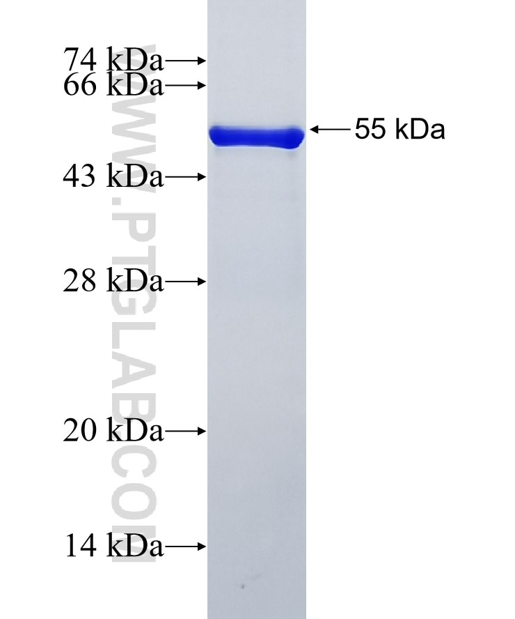 RNF4 fusion protein Ag12115 SDS-PAGE