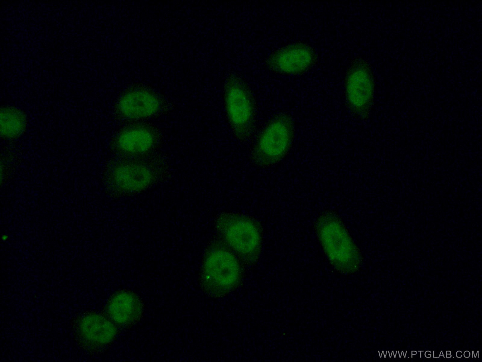 Immunofluorescence (IF) / fluorescent staining of HeLa cells using RNF40 Polyclonal antibody (15621-1-AP)