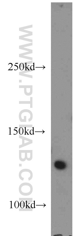 Western Blot (WB) analysis of mouse lung tissue using RNF40 Polyclonal antibody (15621-1-AP)