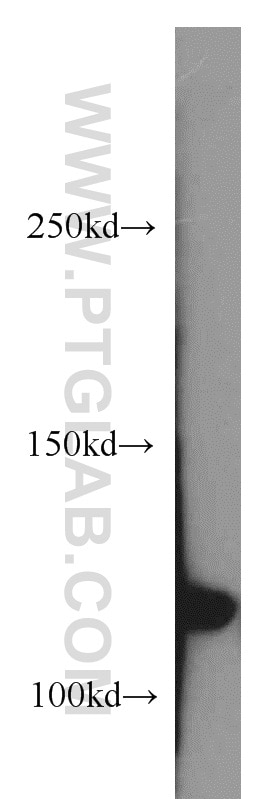 Western Blot (WB) analysis of human brain tissue using RNF40 Polyclonal antibody (15621-1-AP)