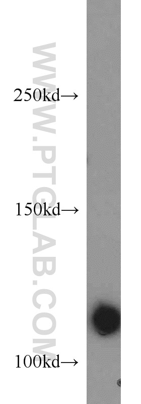 WB analysis of mouse spleen using 15621-1-AP