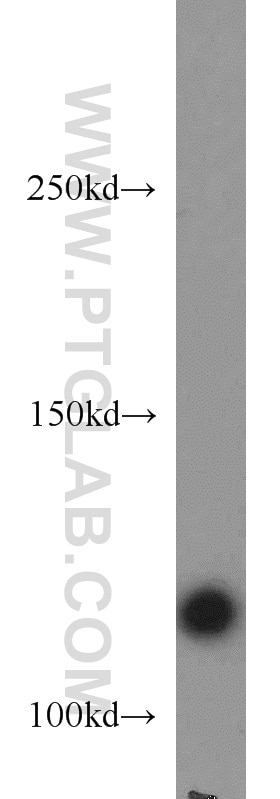 Western Blot (WB) analysis of mouse liver tissue using RNF40 Polyclonal antibody (15621-1-AP)