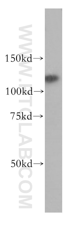 Western Blot (WB) analysis of human brain tissue using RNF40 Polyclonal antibody (15621-1-AP)