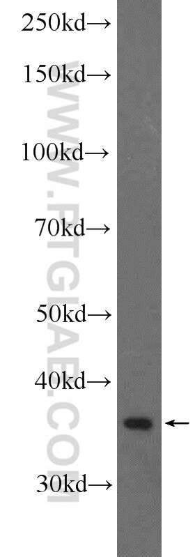 Western Blot (WB) analysis of human testis tissue using RNF41 Polyclonal antibody (17233-1-AP)