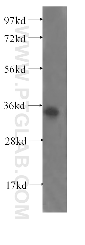Western Blot (WB) analysis of human testis tissue using RNF41 Polyclonal antibody (17233-1-AP)