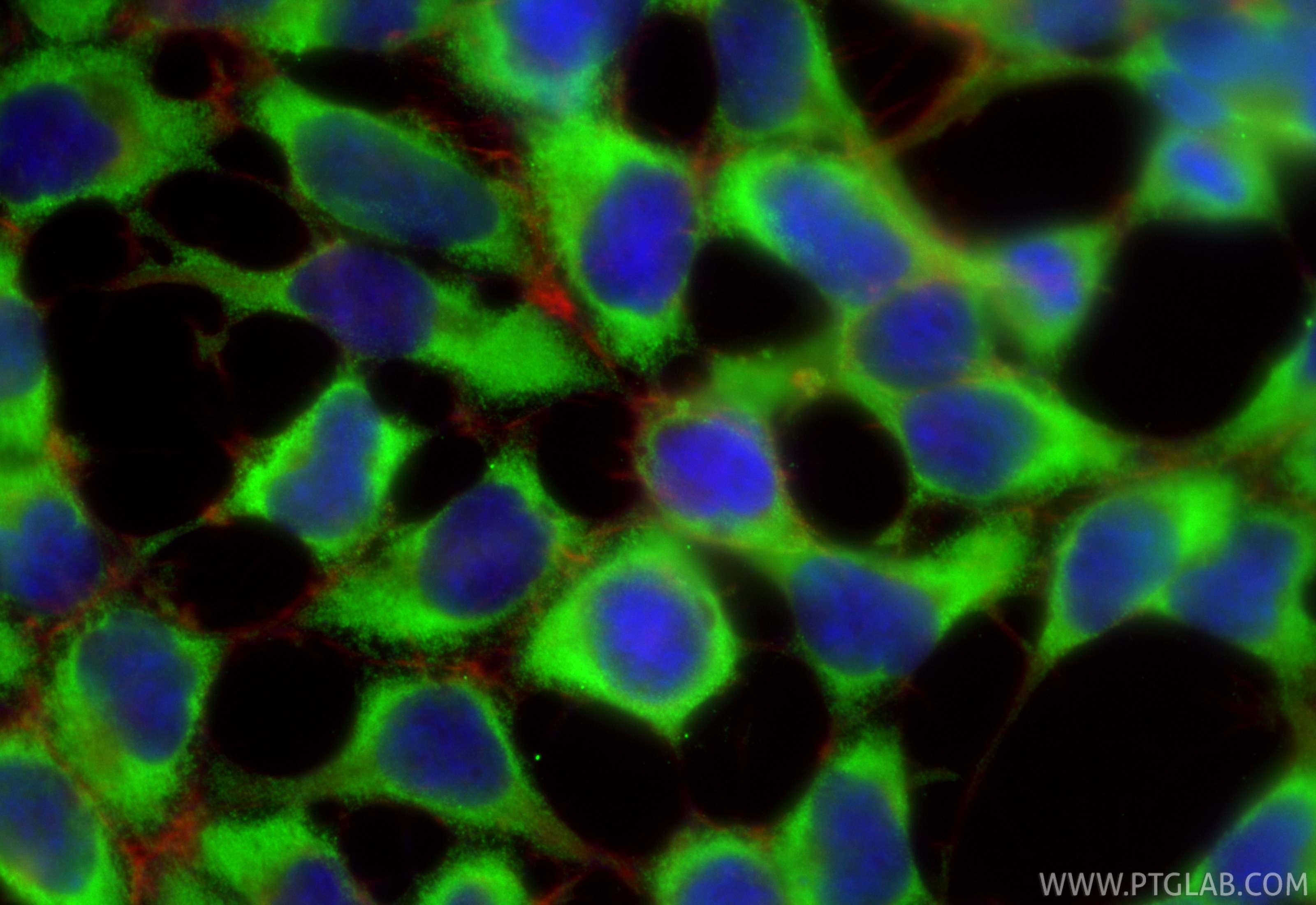 IF Staining of HEK-293 using 86740-1-RR (same clone as 86740-1-PBS) Immunofluorescence (IF) / fluorescent staining of HEK-293 cells using RNF43 Recombinant monoclonal antibody (86740-1-RR)