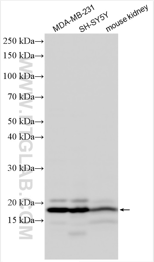 Western Blot (WB) analysis of various lysates using RNF5 Polyclonal antibody (20105-1-AP)