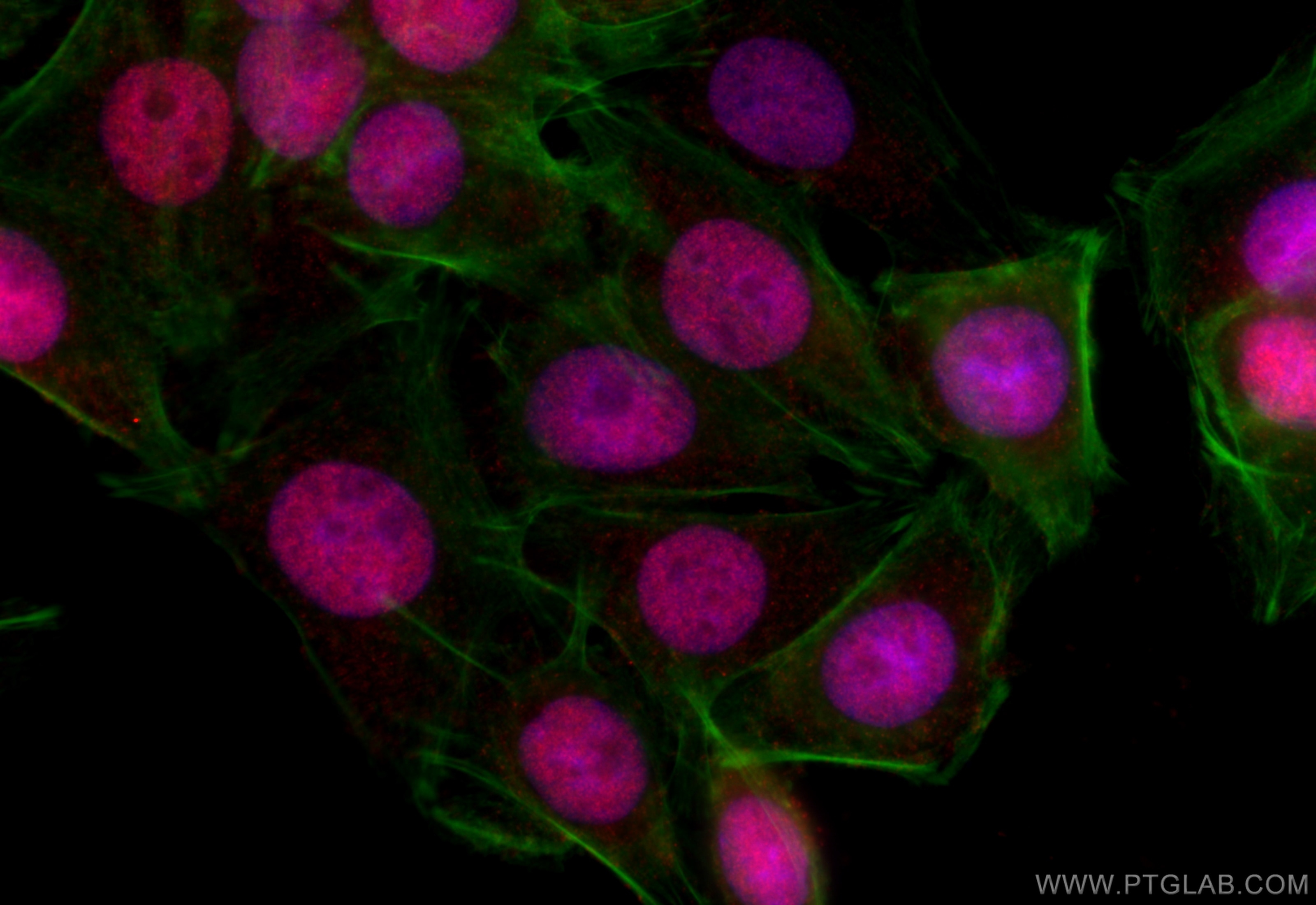 Immunofluorescence (IF) / fluorescent staining of SW480 cells using RNF6 Polyclonal antibody (20437-1-AP)
