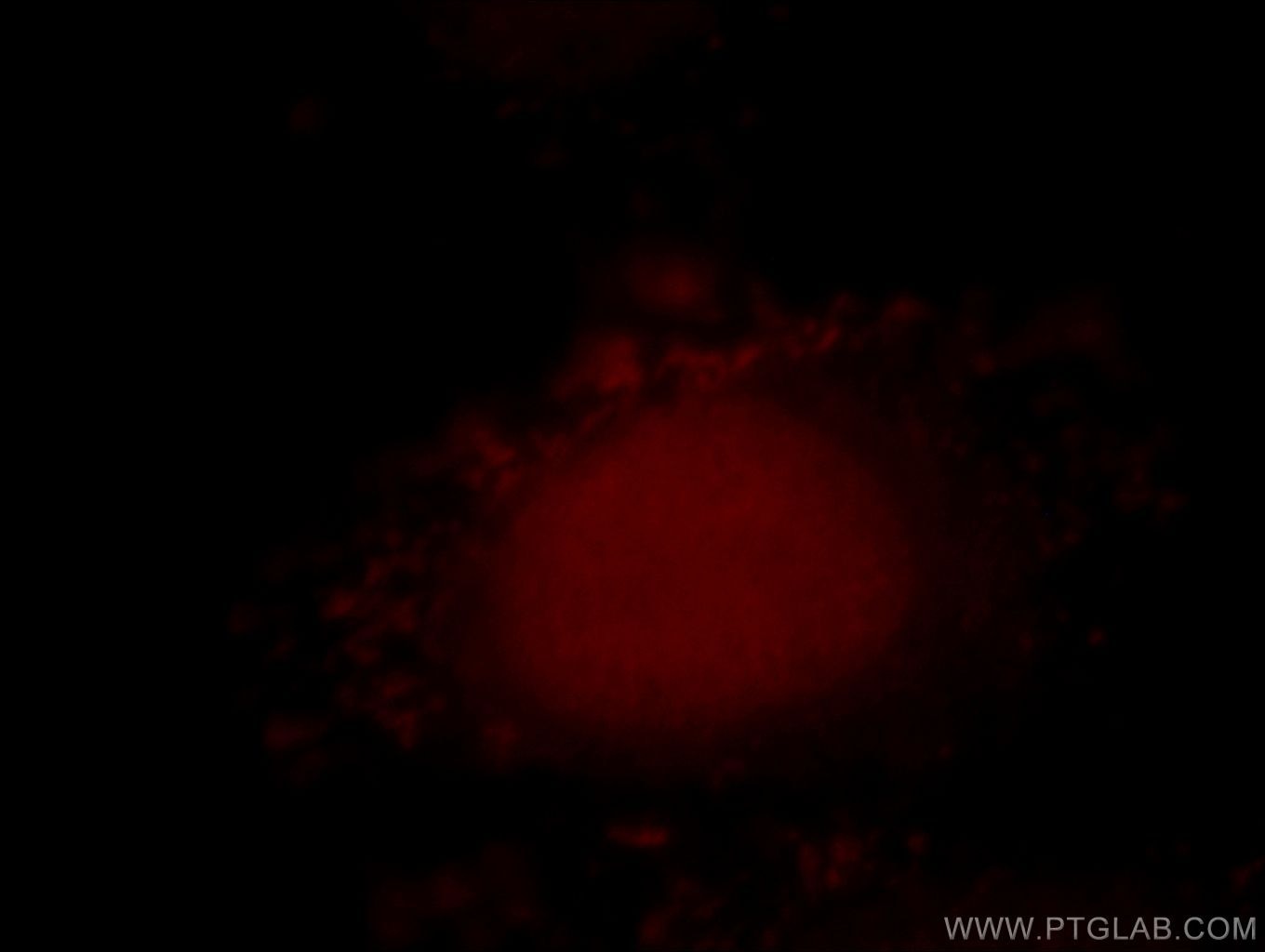 Immunofluorescence (IF) / fluorescent staining of HepG2 cells using RNF6 Polyclonal antibody (20437-1-AP)