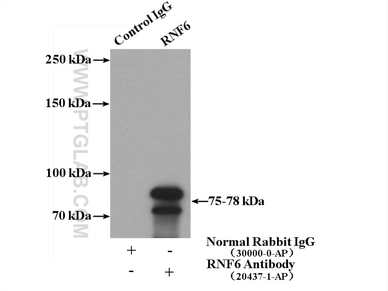 Immunoprecipitation (IP) experiment of mouse testis tissue using RNF6 Polyclonal antibody (20437-1-AP)
