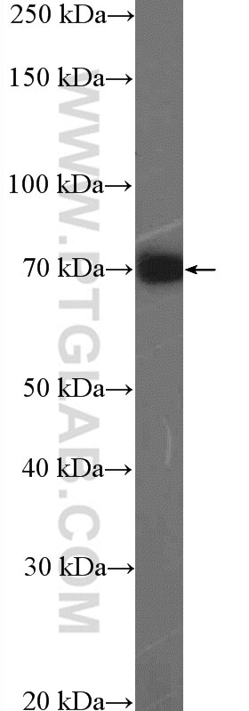 Western Blot (WB) analysis of PC-3 cells using RNF6 Polyclonal antibody (20437-1-AP)