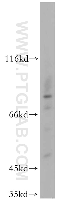 Western Blot (WB) analysis of PC-3 cells using RNF6 Polyclonal antibody (20437-1-AP)