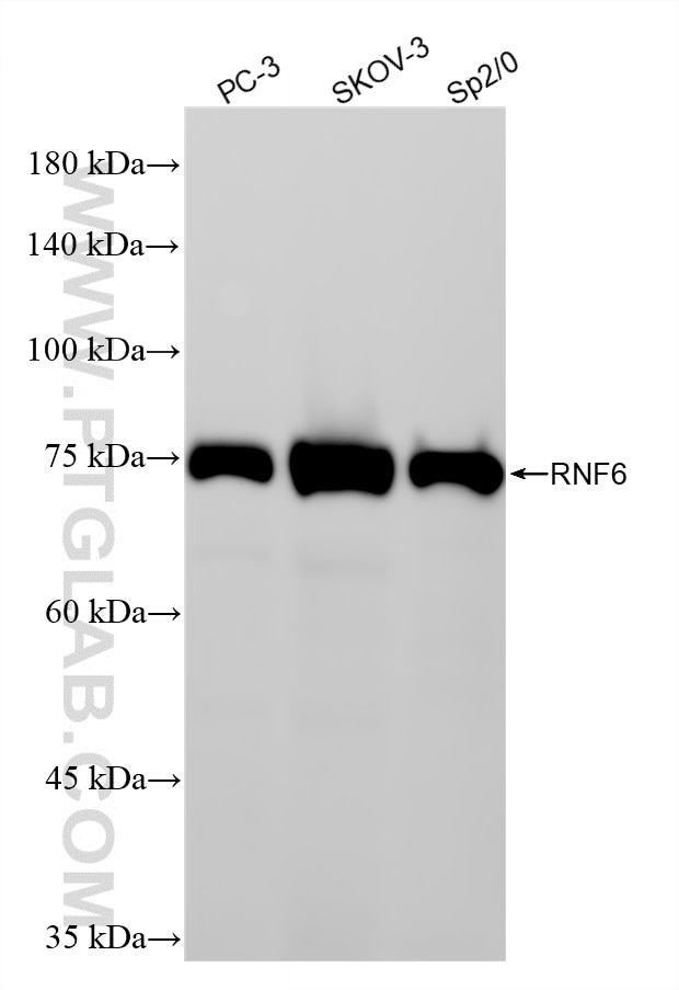 Western Blot (WB) analysis of various lysates using RNF6 Recombinant monoclonal antibody (87086-1-RR)
