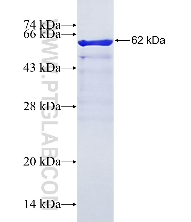 RNF6 fusion protein Ag14209 SDS-PAGE