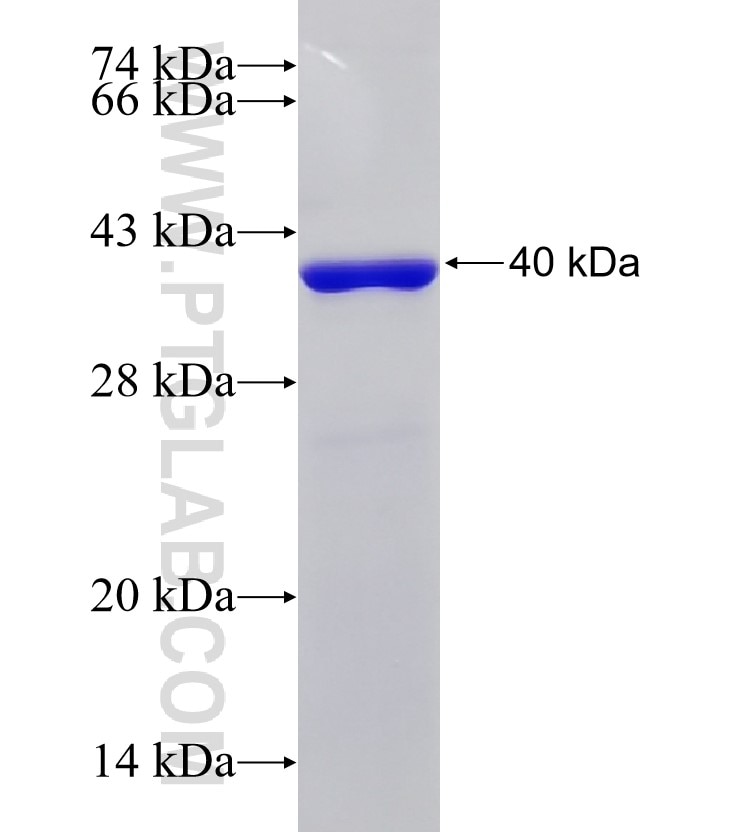 RNF6 fusion protein Ag14899 SDS-PAGE