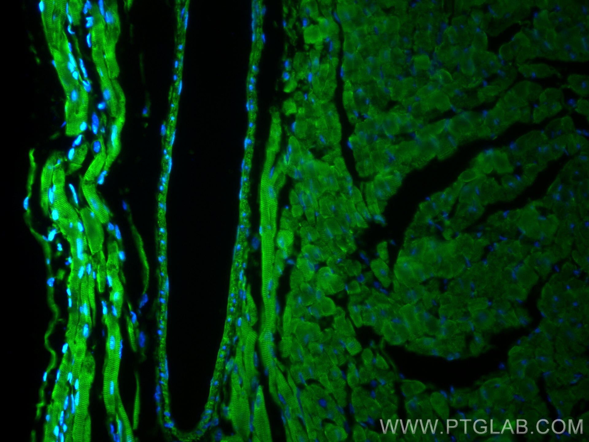 IF Staining of mouse heart using 11905-1-AP