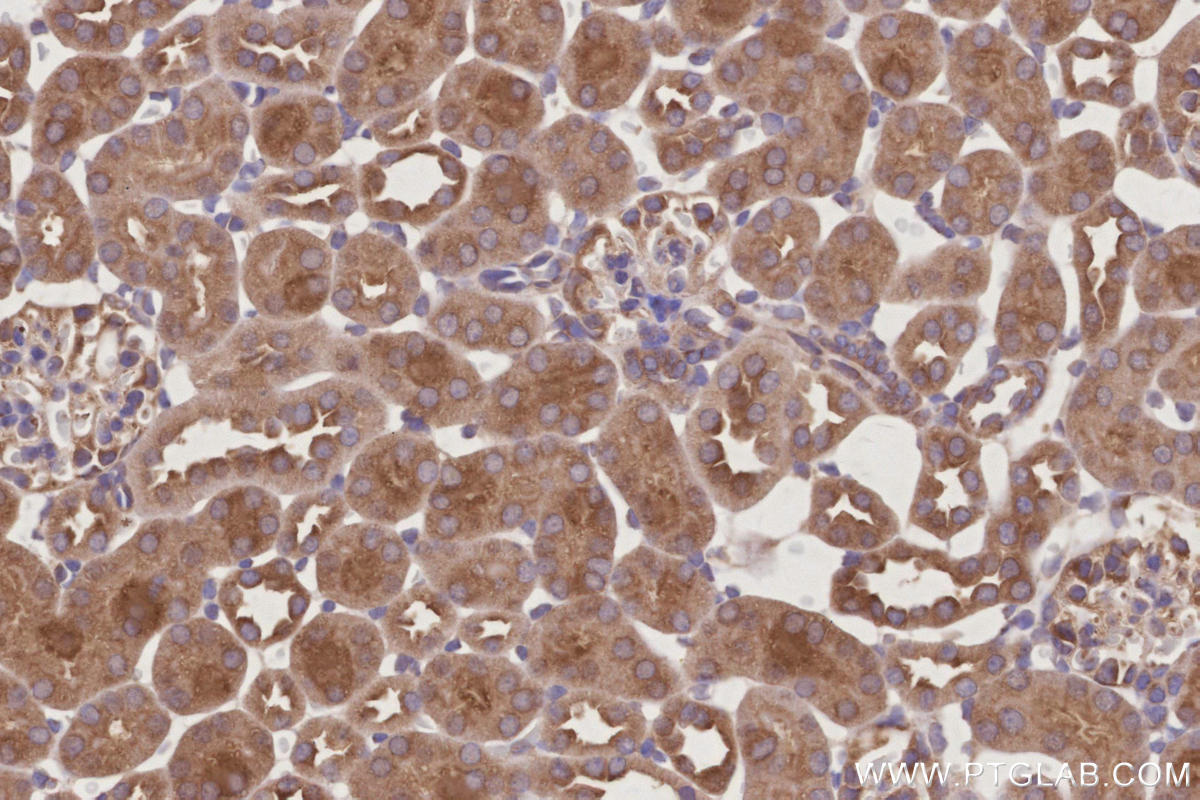 Immunohistochemistry (IHC) staining of mouse kidney tissue using RNF7 Polyclonal antibody (11905-1-AP)