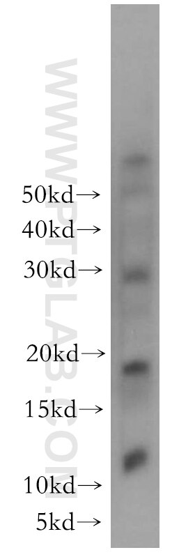 Western Blot (WB) analysis of human heart tissue using RNF7 Polyclonal antibody (11905-1-AP)