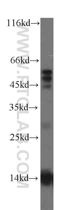 Western Blot (WB) analysis of human heart tissue using RNF7 Polyclonal antibody (11905-1-AP)