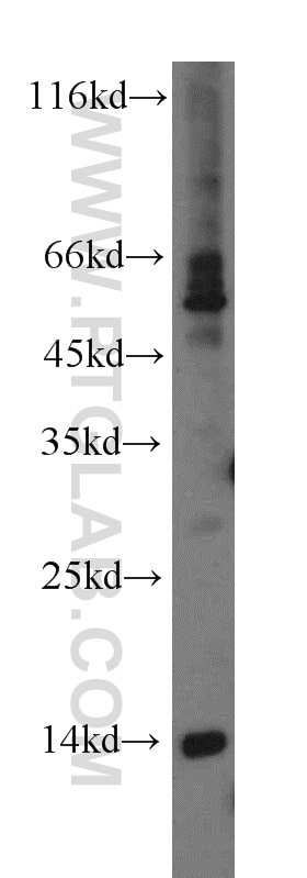 Western Blot (WB) analysis of human skeletal muscle tissue using RNF7 Polyclonal antibody (11905-1-AP)