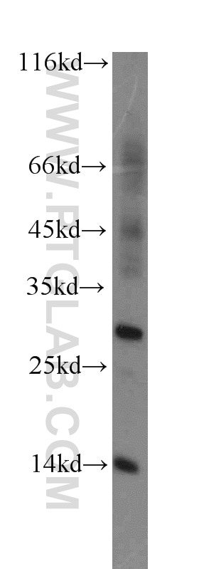 Western Blot (WB) analysis of human liver tissue using RNF7 Polyclonal antibody (11905-1-AP)