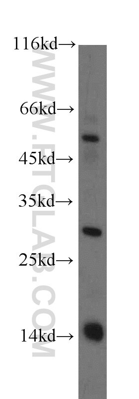 Western Blot (WB) analysis of human testis tissue using RNF7 Polyclonal antibody (11905-1-AP)
