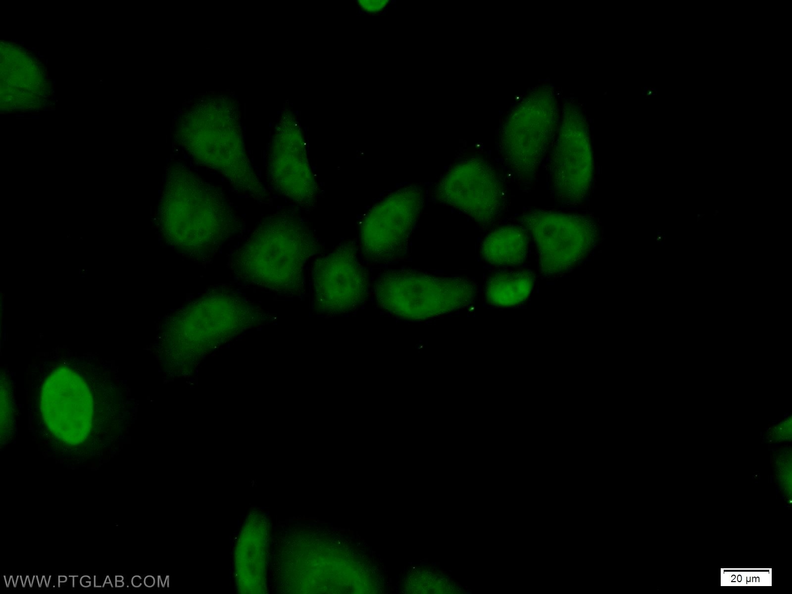 Immunofluorescence (IF) / fluorescent staining of HeLa cells using RNF8 Polyclonal antibody (14112-1-AP)