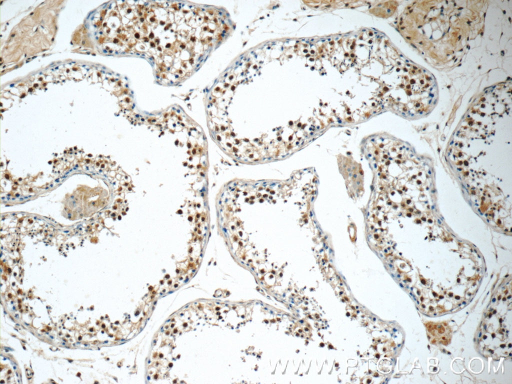 IHC staining of human testis using 14112-1-AP