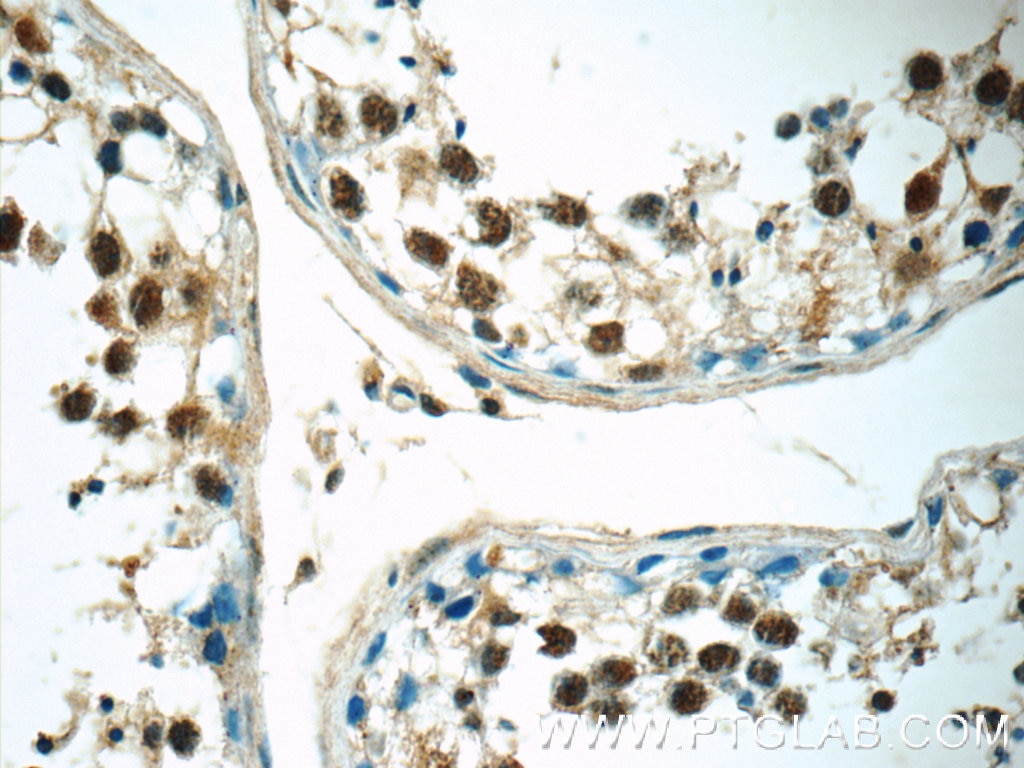 Immunohistochemistry (IHC) staining of human testis tissue using RNF8 Polyclonal antibody (14112-1-AP)