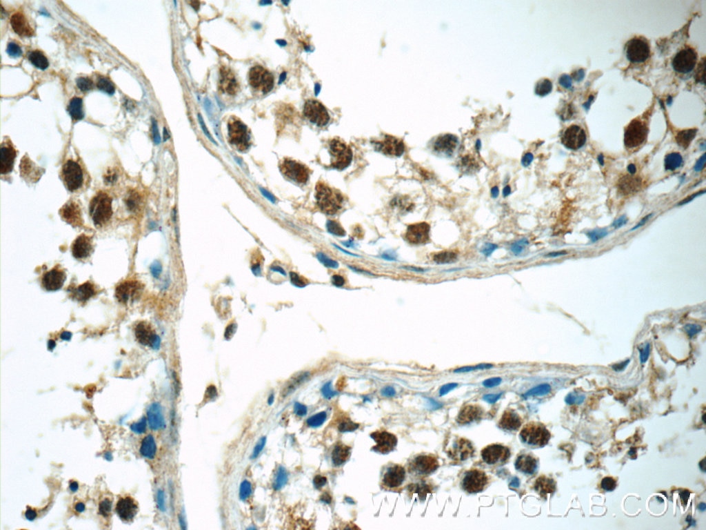 IHC staining of human testis using 14112-1-AP