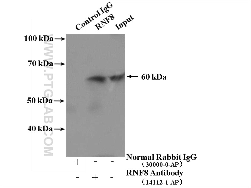 IP experiment of HeLa using 14112-1-AP