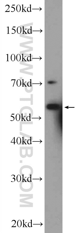Western Blot (WB) analysis of HEK-293 cells using RNF8 Polyclonal antibody (14112-1-AP)